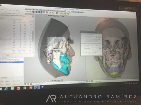 cirugia-ortognatica-_1.jpg