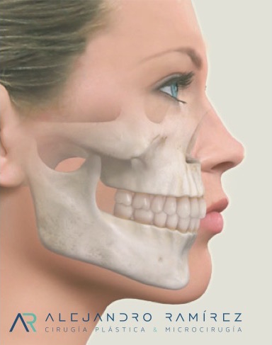 Cheekbone Reduction