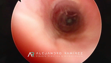 Cirugía Plástica Estética y Reconstructiva Genital  Cosmetic Plastic and Genital Reconstructive Surgery