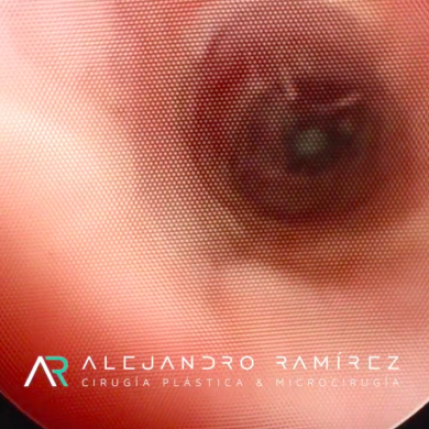 Cirugía Plástica Estética y Reconstructiva Genital  Cosmetic Plastic and Genital Reconstructive Surgery