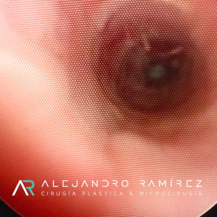 Cirugía Plástica Estética y Reconstructiva Genital  Cosmetic Plastic and Genital Reconstructive Surgery