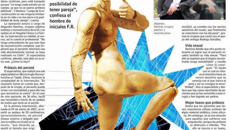 (Español) Avances en Cirugía Plástica Genital Estética y Reconstructiva: Reportaje LUN.