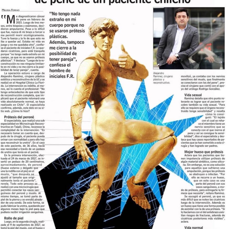 [:es]Avances en Cirugía Plástica Genital Estética y Reconstructiva: Reportaje LUN.Advances in Cosmetic and Reconstructive Genital Plastic Surgery: LUN article.[:]